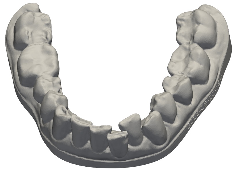 Processed lower-jaw horseshoe model with a clean prepared base