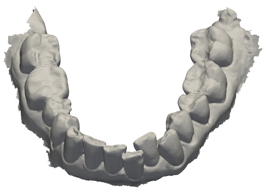 Original lower-jaw 3D scan with an uneven unfinished edge